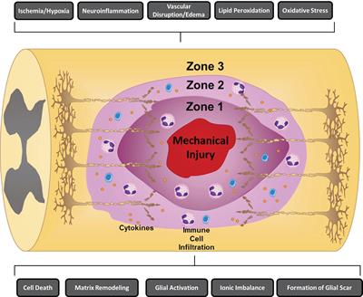 Immune response following traumatic spinal cord injury: Pathophysiology and therapies